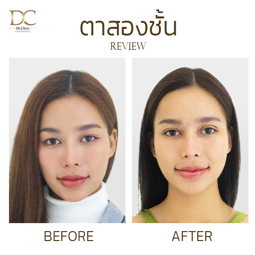 รีวิวตาสองชั้น | มิสแกรนด์เชียงใหม่ 2024