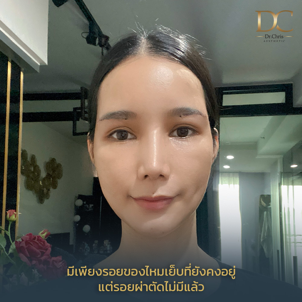 Result Gallery